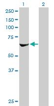 Anti-RPS6KB2 Mouse Monoclonal Antibody [clone: 4B11]