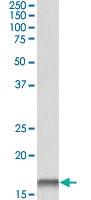 Anti-CSTB Goat Polyclonal Antibody