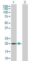 Anti-NUDT3 Mouse Polyclonal Antibody