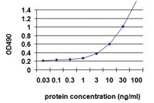 Anti-IL1B Polyclonal Antibody Pair