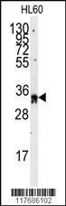 Anti-EXOSC8 Rabbit polyclonal antibody