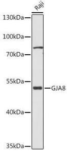 Western blot analysis of extracts of Raji cells, using Anti-Cx50 Antibody (A308599) at 1:1,000 dilution. The secondary antibody was Goat Anti-Rabbit IgG H&L Antibody (HRP) at 1:10,000 dilution.