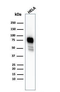 Anti-CD44 Rabbit Recombinant Antibody [clone: HCAM/2875R]