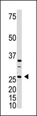 Anti-DKK4 Rabbit Polyclonal Antibody