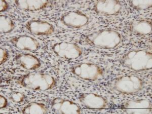 Anti-CSE1L Mouse Monoclonal Antibody [clone: 2C10]