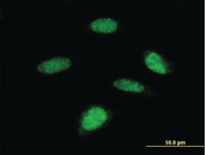 Anti-RPS6KB2 Mouse Monoclonal Antibody [clone: 4B11]