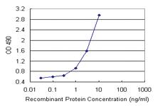 Anti-DCXR Polyclonal Antibody Pair