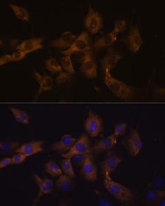 Immunofluorescence analysis of C6 cells using Anti-Cx50 Antibody (A308599) at a dilution of 1:100. DAPI was used to stain the cell nuclei (blue).