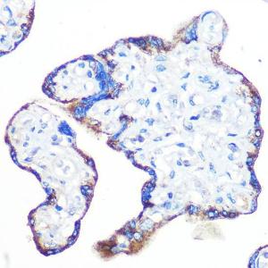 Immunohistochemistry analysis of paraffin-embedded human placenta using Anti-Epac1 Antibody [ARC0908] (A305876) at a dilution of 1:100 (40x lens). Perform microwave antigen retrieval with 10 mM PBS buffer pH 7.2 before commencing with IHC staining protocol.