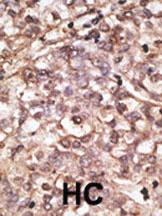 Anti-DKK4 Rabbit Polyclonal Antibody