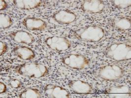 Anti-CSE1L Mouse Monoclonal Antibody [clone: 2C10]