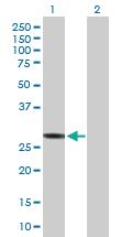 Anti-HLA-DRB3 Mouse Polyclonal Antibody