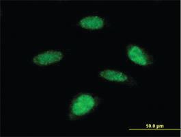 Anti-RPS6KB2 Mouse Monoclonal Antibody [clone: 4B11]