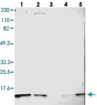 Anti-DYNLT3 Rabbit Polyclonal Antibody