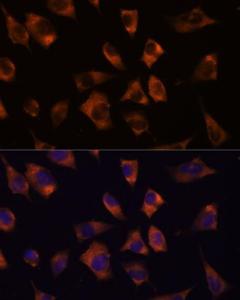 Immunofluorescence analysis of L929 cells using Anti-Cx50 Antibody (A308599) at a dilution of 1:100. DAPI was used to stain the cell nuclei (blue).