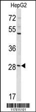 Anti-CCDC85B Rabbit Polyclonal Antibody