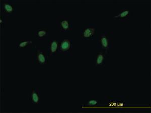 Anti-CSE1L Mouse Monoclonal Antibody [clone: 2C10]