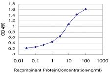 Anti-RPS6KB2 Mouse Monoclonal Antibody [clone: 4B11]