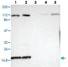 Anti-RPL12 Rabbit Polyclonal Antibody