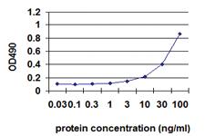 Anti-IL1B Polyclonal Antibody Pair