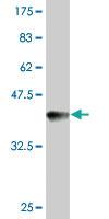 Anti-FANCC Mouse Monoclonal Antibody [clone: 6E7]