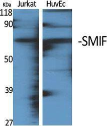 Anti-DCP1A antibody