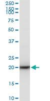 Anti-RPS7 Mouse Polyclonal Antibody