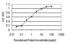 Anti-NUDT3 Mouse Monoclonal Antibody [clone: 3C5]