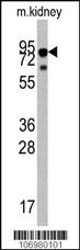 Anti-CREG2 Rabbit Polyclonal Antibody