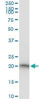 Anti-RPS7 Mouse Polyclonal Antibody