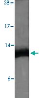 Anti-ENHO Rabbit Polyclonal Antibody