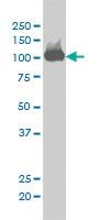 Anti-CSE1L Mouse Monoclonal Antibody [clone: 2C10]