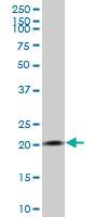 Anti-RPS7 Mouse Polyclonal Antibody