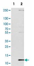 Anti-DYNLT3 Rabbit Polyclonal Antibody