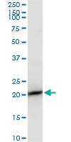 Anti-RPS7 Mouse Polyclonal Antibody