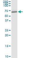 Anti-FANCC Polyclonal Antibody Pair