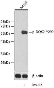 Western blot analysis of extracts from Jurkat cells using Anti-DOK2 (phospho Tyr299) Antibody (A10905). The secondary antibody was Goat Anti-Rabbit IgG H and L Antibody (HRP) at 1:10,000 dilution. Lysates/proteins were present at 25 µg per lane. The blocking buffer used was 3% BSA