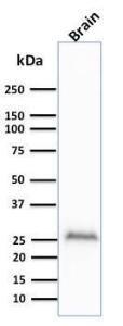 Western blot analysis of human brain lysate using Anti-PGP9.5 Antibody [UCHL1/841]