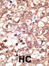 Anti-KREMEN1 Rabbit Polyclonal Antibody