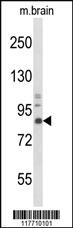 Anti-NTRK1 Rabbit Polyclonal Antibody