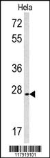 Anti-CREM Rabbit Polyclonal Antibody