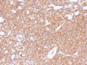 Immunohistochemical analysis of formalin-fixed, paraffin-embedded human tonsil using Anti-CD44 Antibody [HCAM/4110R]