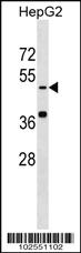 Anti-KREMEN1 Rabbit Polyclonal Antibody