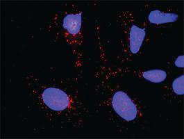 Anti-KLK3 + A2M Antibody Pair