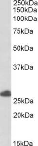 EB05890 (0.5 µg/ml) staining of Human Placenta lysate (35 µg protein in RIPA buffer). Primary incubation was 1 hour. Detected by chemiluminescence.