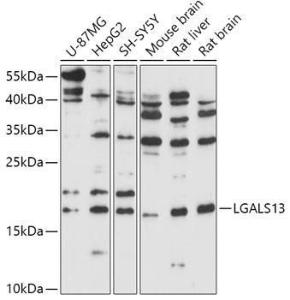 Western blot analysis of extracts of various cell lines, using Anti-Galectin 13/PLAC8 Antibody (A305878) at 1:1,000 dilution