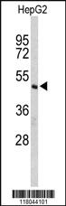 Anti-CFLAR Rabbit Polyclonal Antibody