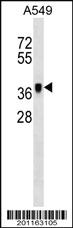 Anti-METAP1 Mouse Monoclonal Antibody