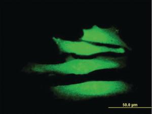 Anti-SMARCA2 Mouse Monoclonal Antibody [clone: 2D12]