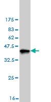 Anti-DCXR Mouse Monoclonal Antibody [clone: 6A6]